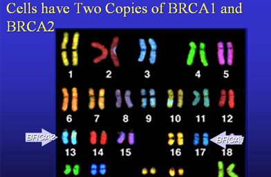 
                    Each cell (except for sperm and egg cells) have two copies of each chromosome in its nucleus. This provides cells with a backup in case one gene copy becomes mutated. This is especially important for "tumor suppressor genes" such as BRCA1 and BRCA2 that normally play a critical role in preventing cells from becoming cancerous.
                                            (Joyce Seldon)
                                        