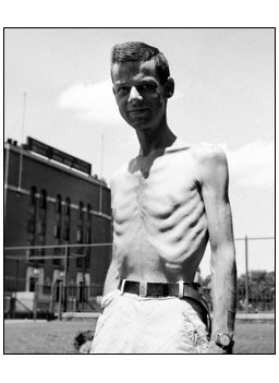 
                    Starvation experiment participant Sam Legg.
                                            (Time & Life Pictures / Getty Images)
                                        
