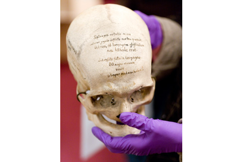 
                    The Hyrtl collection at the Mutter Museum includes 139 skulls from Europe. Each skull's brief story is written in German right on the bone.
                                            (Todd Vachon/WHYY)
                                        
