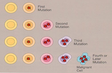 
                    The cancer blobs. When a woman has a mutation on BRCA1 or BRCA2, she's already on the first mutation.
                                            (Joyce Seldon)
                                        